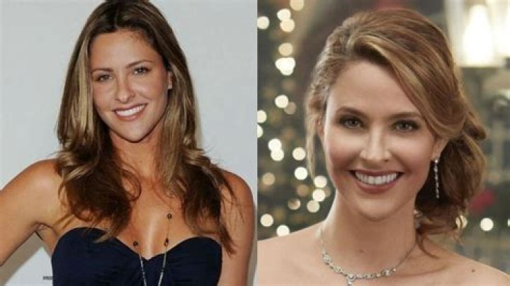 Did Jill Wagner Have Plastic Surgery? Facelift? Botox?