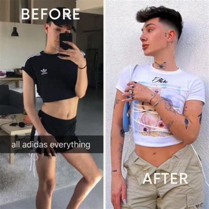 Ella Bands Before Surgery | Did She Have BBL