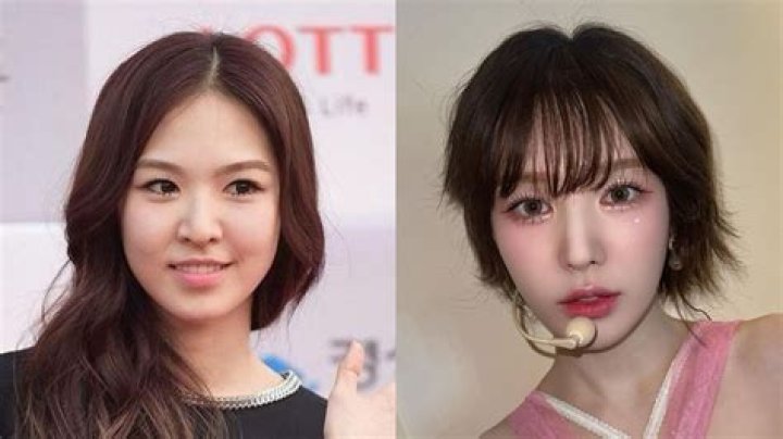 Has Wendy From Red Velvet Undergone Plastic Surgery?