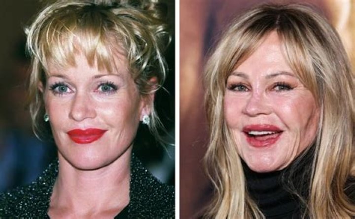 Jenny Marrs’ Lips Were Painted, Or Not? Photos Of Plastic Surgery Before And After