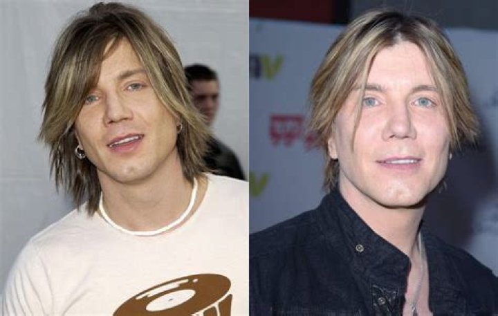 John Rzeznik Facelift | Goo Goo Dolls Frontman Plastic Surgery Before And After