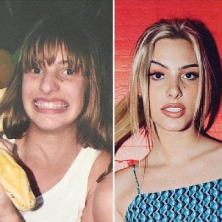 Lele Pons Plastic Surgery: ‘Dance Monsters Judge’ Before And After Photo