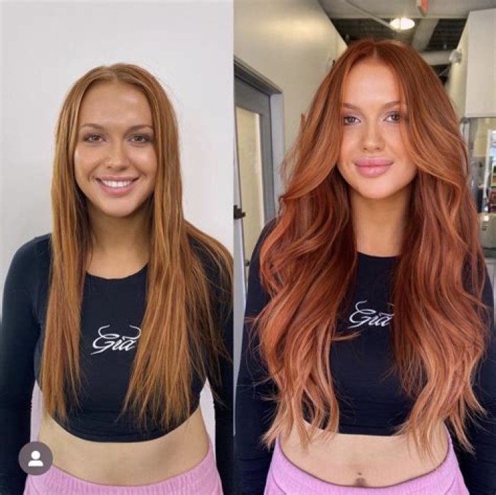 Sydney Love Island Before Surgery | Sydney Paight Before And After Photos